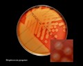 streptococcus pyogenes